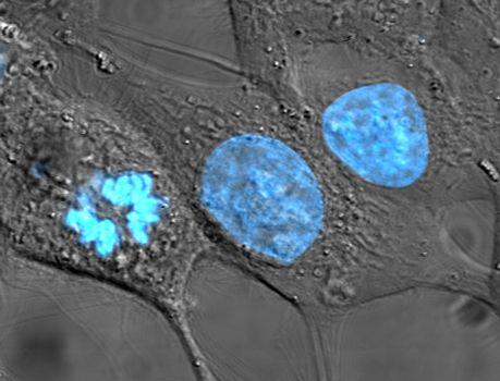 IVF (Inverted File Index) does